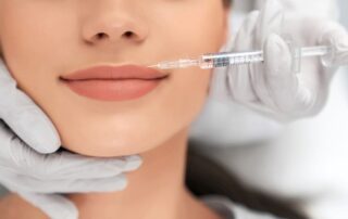 Aumento de labios en Clínica Dental Valcárcel